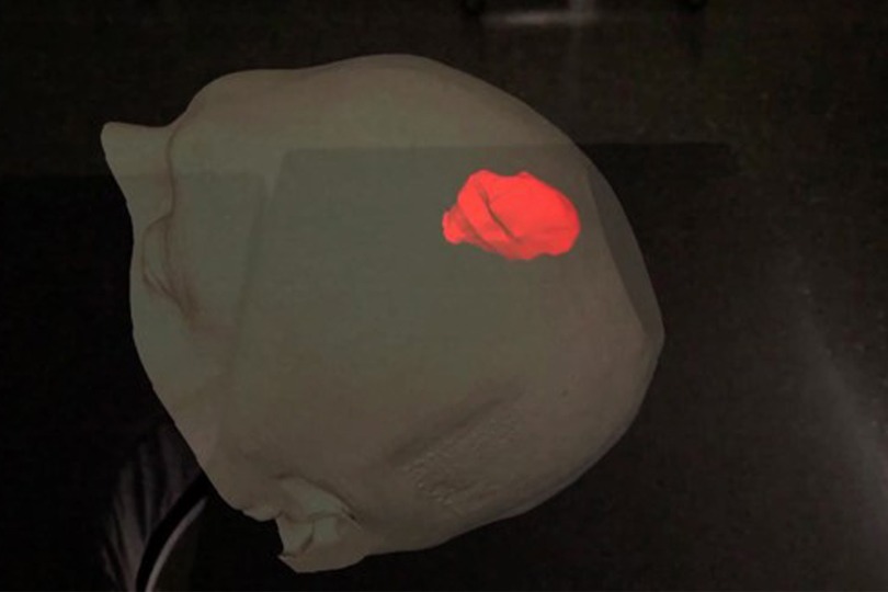 The surgeon sees virtually right into the patient's head